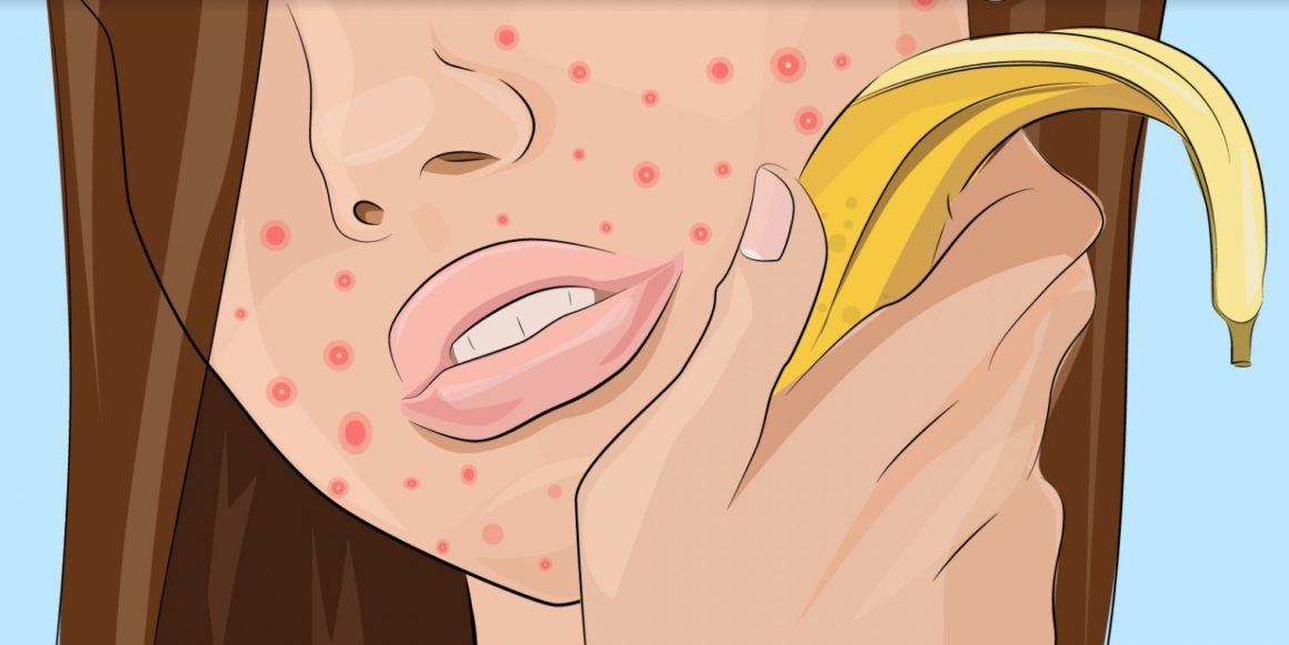 Dit is de reden waarom je een bananenschil niet moet weg te gooien!