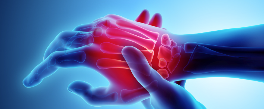 Dokters vertellen: jouw handen waarschuwen je voor deze gezondheidsproblemen!