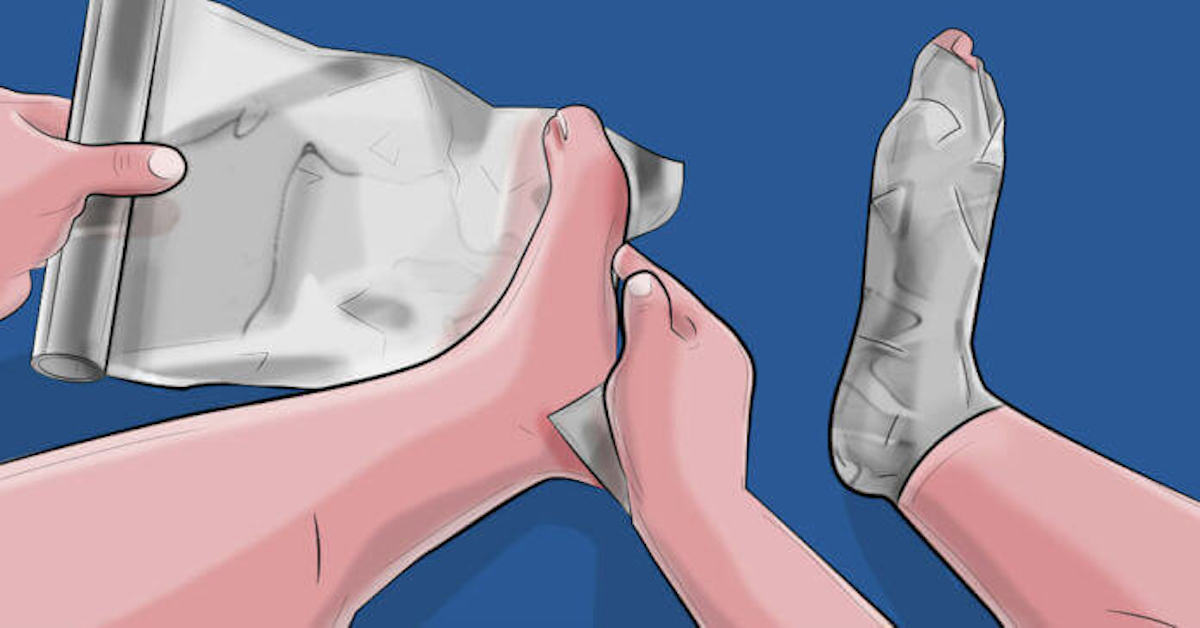 Wikkel aluminiumfolie om je voeten en een paar uur later krijg je dit als resultaat