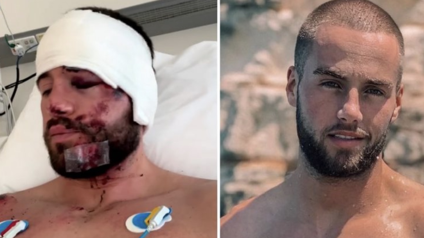 NET BINNEN: Wederom slecht nieuws voor Donny Roelvink