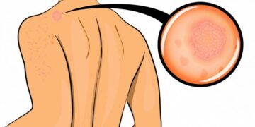 9 waarschuwingssignalen die ons lichaam jou geeft die je direct serieus moet nemen