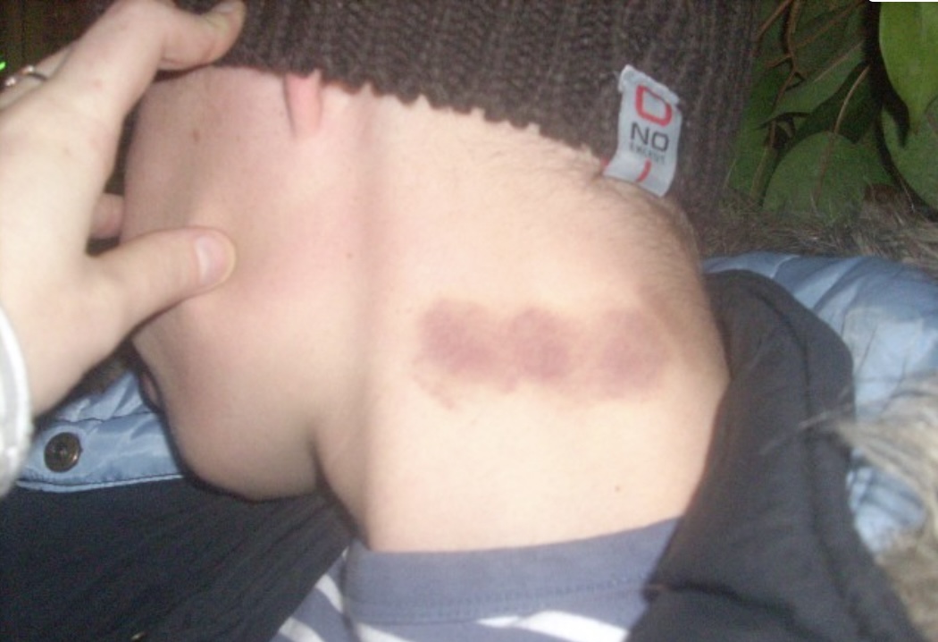 Hij kreeg een zuigzoen van zijn vriendin, maar uren later gebeurde er iets verschrikkelijks