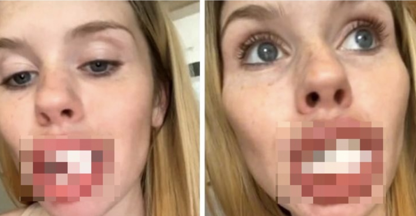 “Ik droomde van een perfecte glimlach: nu zie ik eruit als een paard”