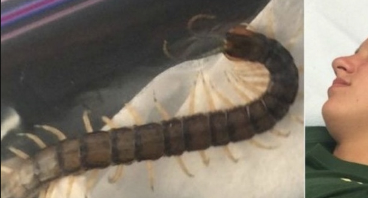 ZIEN: Vrouw heeft last van oorpijn. Wat de artsen dan aantreffen verwacht niemand