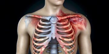 Pijn op je borst? Dat kan mogelijk wijzen op DIT syndroom!