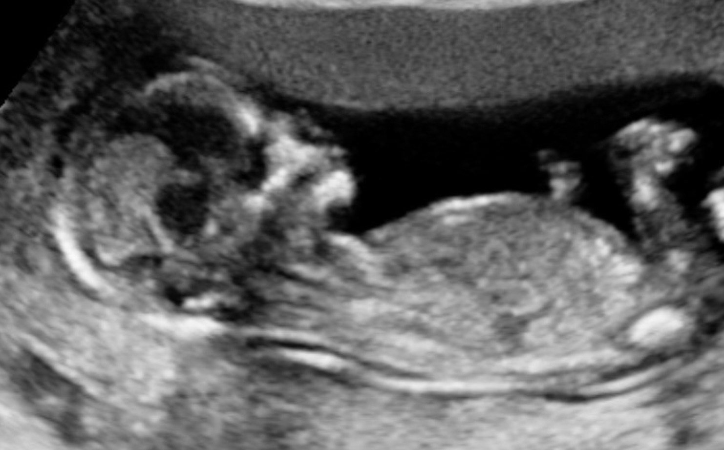 NET BINNEN: Deze MAFS- deelnemer verwacht een baby