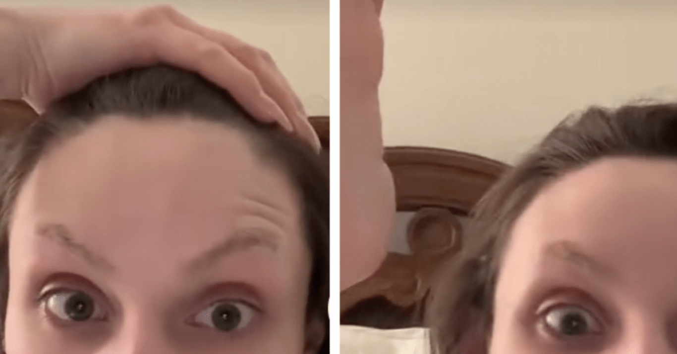 ZIEN: Vrouw drukt ‘puistje’ uit – maar er komt iets anders uit