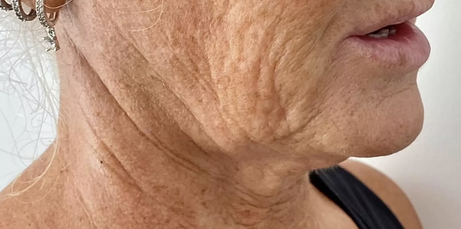 Dit is de grootste fout die vrouwen maken bij gezichtsverzorging (en het maakt de situatie erger)