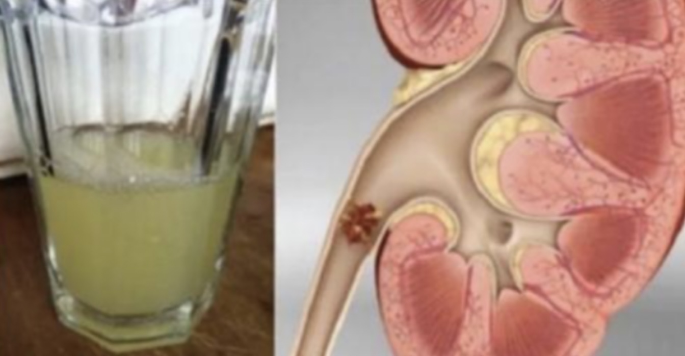 Elke dag citroensap drinken? Dit doet het met het lichaam!