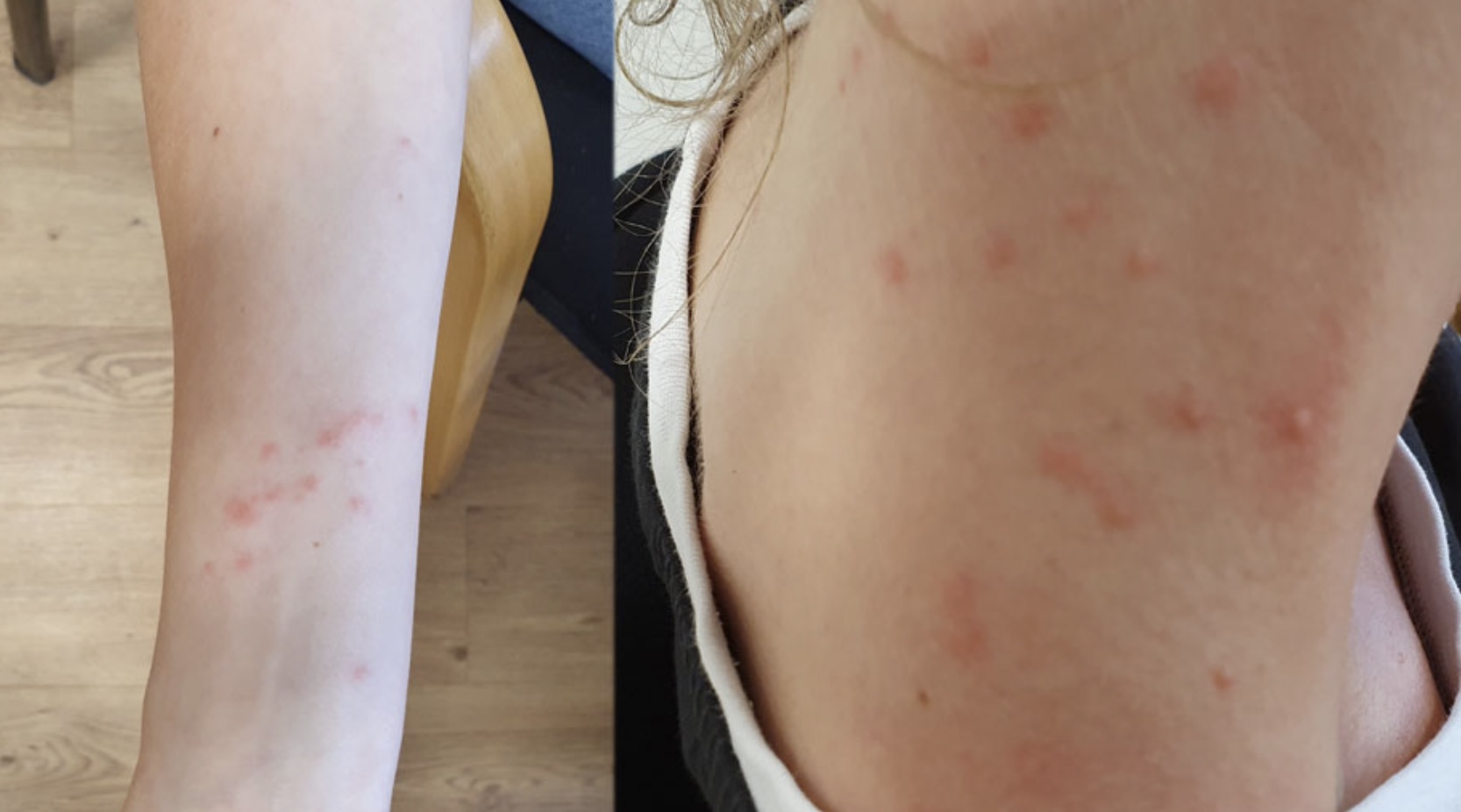 GGD SLAAT ALARM: Explosie van gevaarlijke bastaardsatijnrupsen