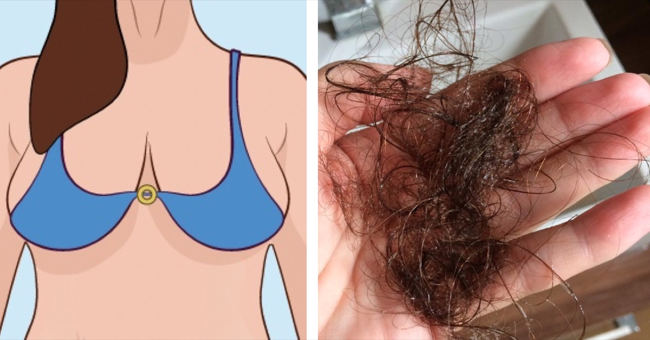 Alarmerend: 8 tekenen dat je te veel oestrogeen hebt (velen weten dit niet)