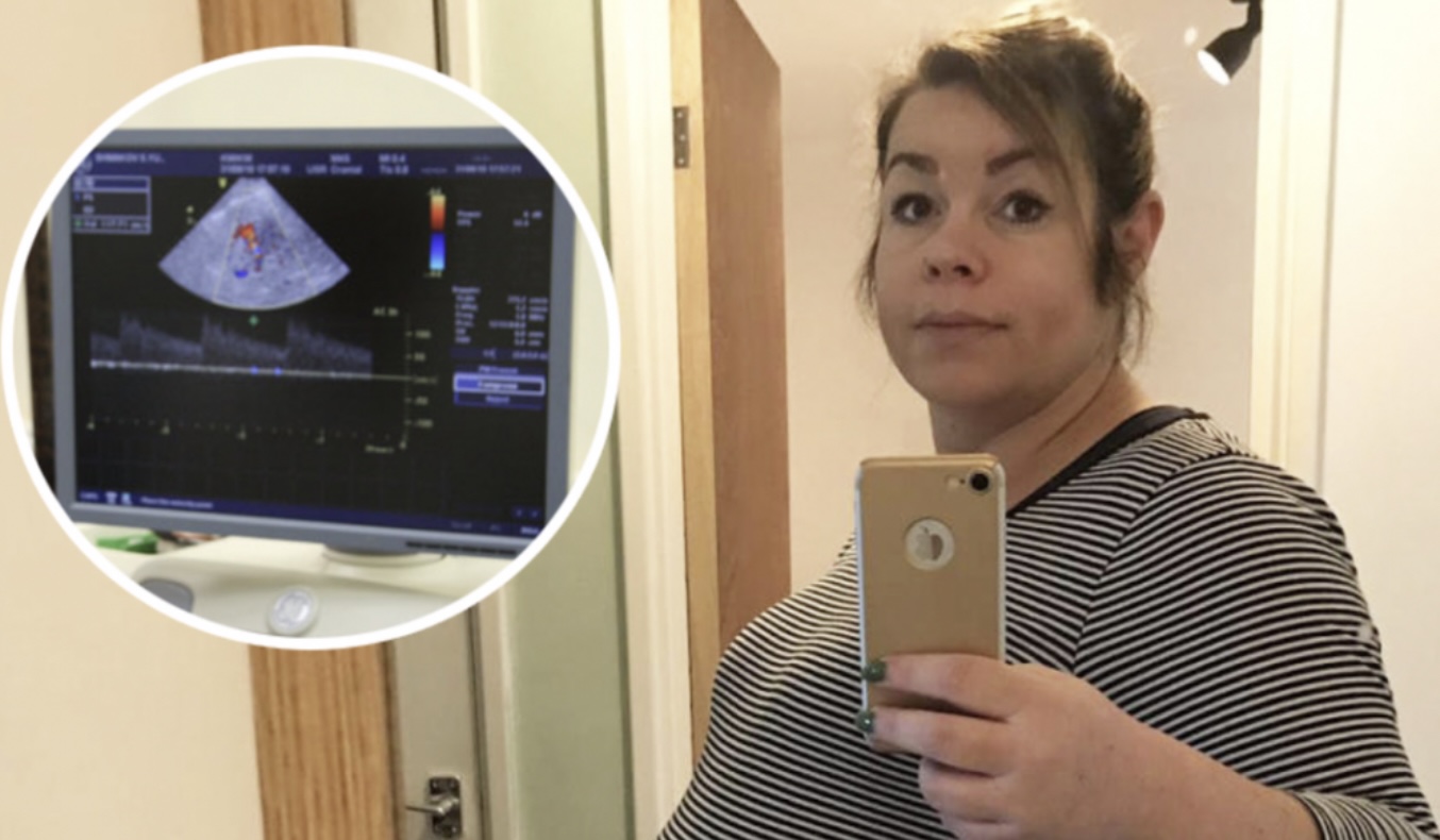 Vrouw lukt het 8 jaar lang niet om zwanger te worden. Als dokter echo maakt valt ze flauw