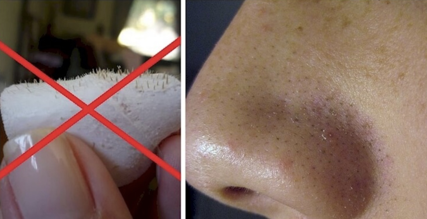 Schoonheidsspecialist onthult: Als je dit middeltje als huidreiniger straalt deze als nooit tevoren