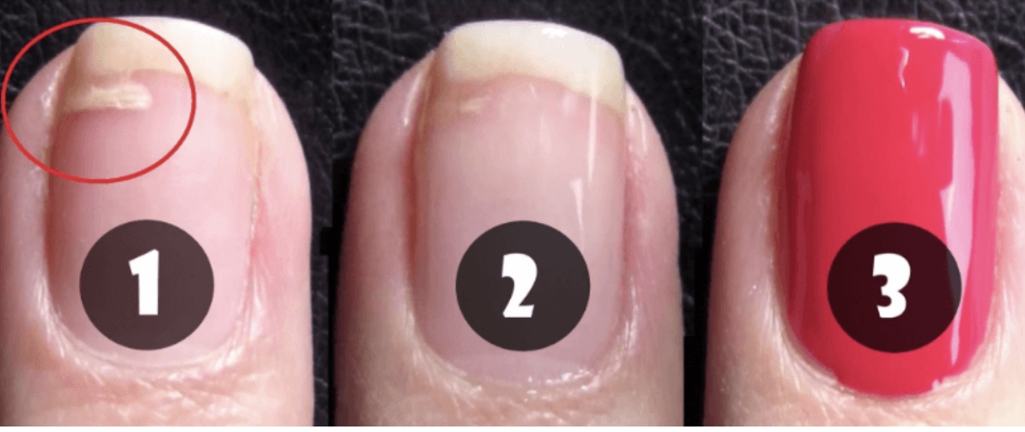 Nagel gescheurd? Met dit ongewone trucje heb je je nagel snel gerepareerd!