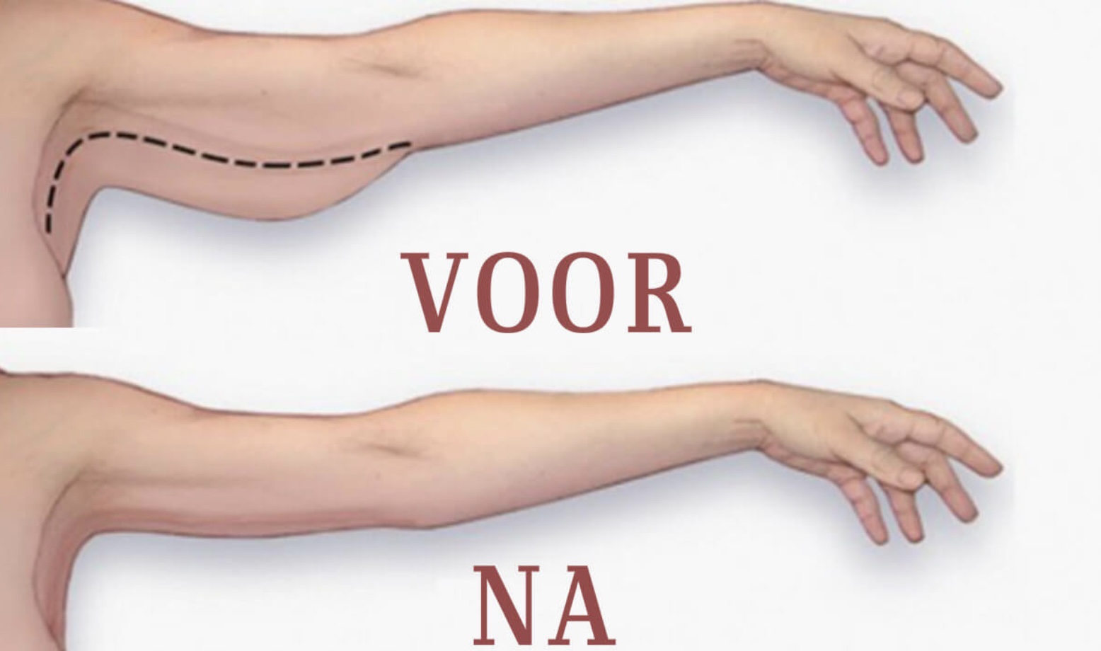 Verlies armvet in 3 minuten per dag met deze oefening