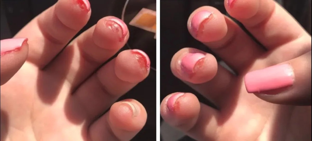 Heb jij (kunst) gelnagellak? Het kan ernstige gevolgen hebben voor jouw gezondheid!