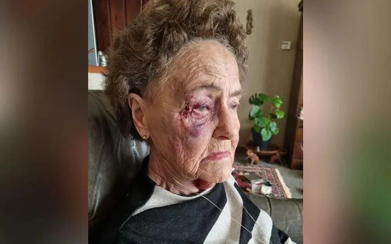 Dicky (84) zwaar toegetakeld door groepje jongeren: “Ik durf niet meer naar buiten”