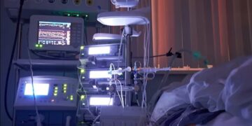 Kind wordt van beademing gehaald, begint dan zelf te ademen