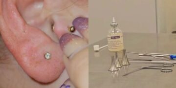 Dit is toch je grootste nachtmerrie! ”Zilvervisje vast in mijn oor, ik hoorde het kruipen.”