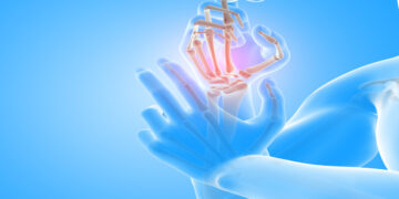 Dit zijn de 5 meest vroege signalen van reuma