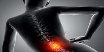 Pijn in je rug? Zo weet je of het een rughernia is