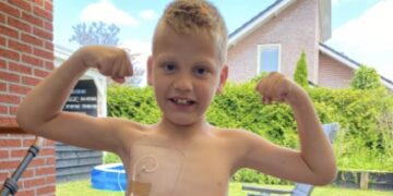 Help Kian om na 49 operaties iets terug doen voor de kinderafdeling van het Beatrix kinderziekenhuis