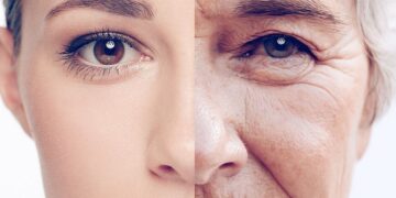 Let op: door deze voedingsmiddelen krijg je sneller rimpels