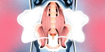 Psoas spier: 5 praktische tips waarom het superbelangrijk is om deze spier te ontspannen