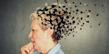 Dit zijn de eerste tekenen van dementie die je in de gaten moet houden