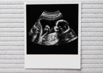 Babynieuws! Bij déze bekende familie is een baby op komst