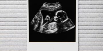 Babynieuws! Bij déze bekende familie is een baby op komst