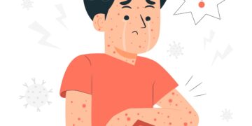 Let op: steeds meer besmettingen: zo gevaarlijk zijn de mazelen (en zo herken je de symptomen).