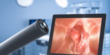 Experts onthullen de 5 tekenen dat je eerder dan je 45e een colonoscopie nodig hebt