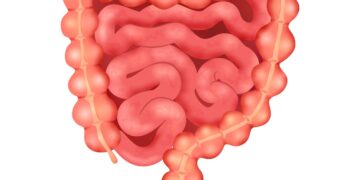 Steeds meer mensen onder 50 krijgen darmkanker – deze bacterie zou weleens de oorzaak kunnen zijn