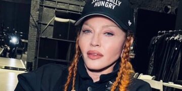 Queen of Pop Madonna ondergaat totale gezichtsverandering: ‘Alle fillers opgelost!’