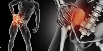 Dit is hoe je een versleten heup herkent (en wat je ertegen moet doen)