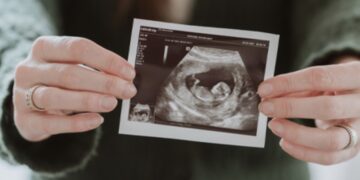 Dit BN’er stel is in verwachting van hun eerste kindje