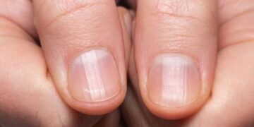 Met dit middeltje maak je je nagels veel sterker (volgens experts)