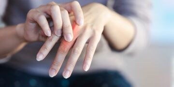 Reuma of artrose? Dít dieet werkt bijna net zo goed werken als medicijnen