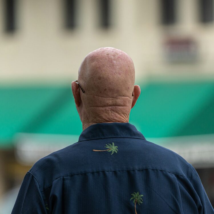 A man with a bald head walking down a street