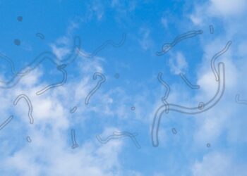 Dit moet je doen als je ‘floaters’ in je ogen ziet…