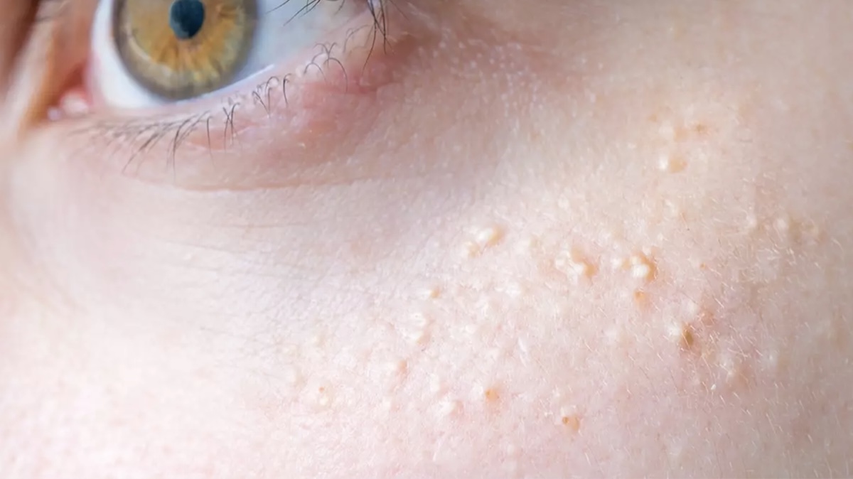 Screenshot - Info Vandaag