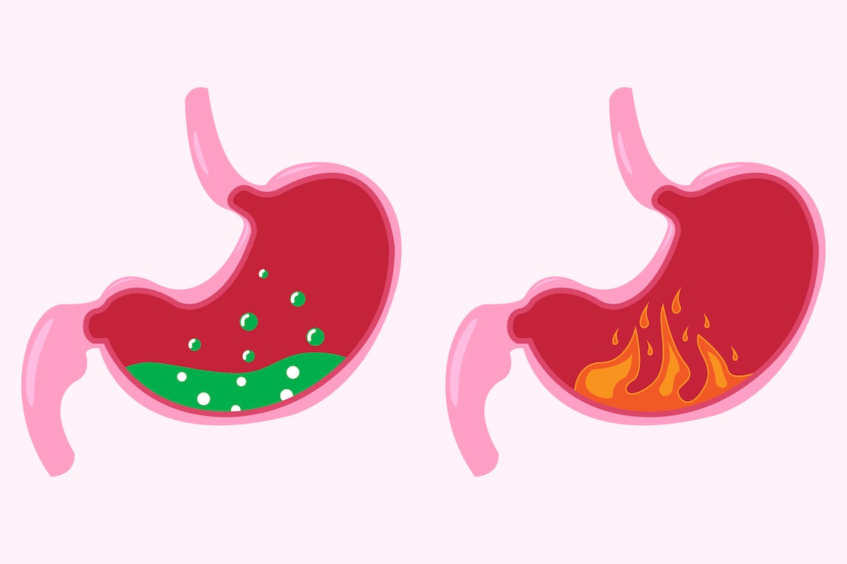maagzuur - Info Vandaag