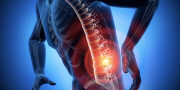 Last van je rug? Met deze simpele tip ben je er heel snel vanaf