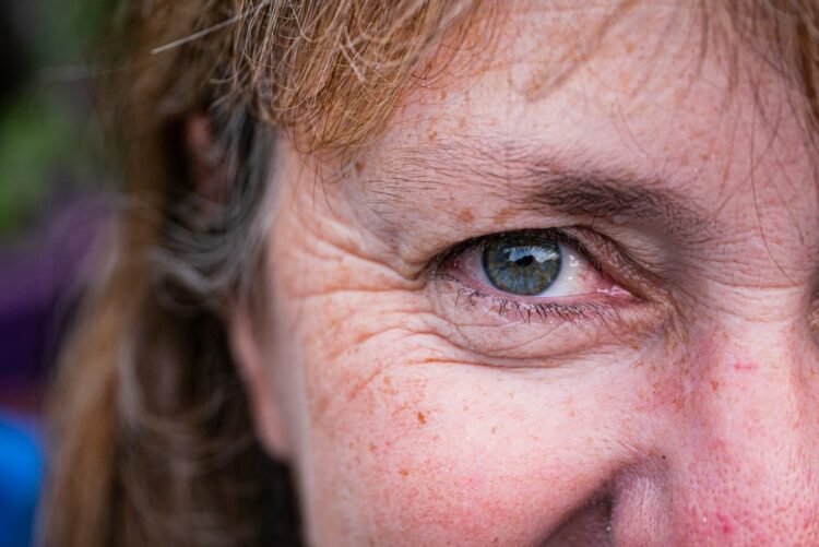 A close up of a person with freckled hair