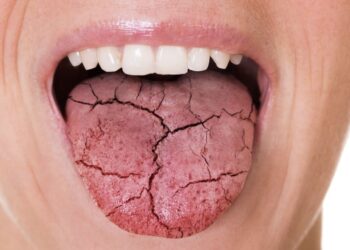 Dit is de redenen waarom je mond ’s nachts altijd droog aanvoelt (het is niet wat je denkt)