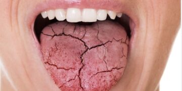 Dit is de redenen waarom je mond ’s nachts altijd droog aanvoelt (het is niet wat je denkt)