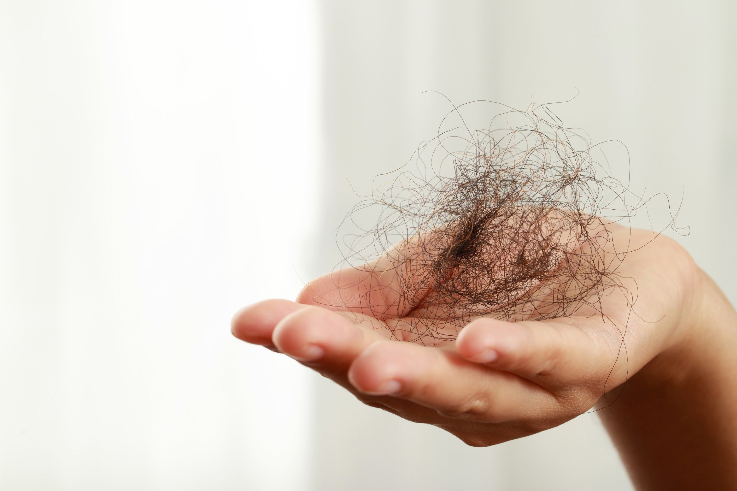 haaruitval - Info Vandaag