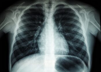 Black and white abstract painting