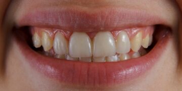 a close-up of a person's mouth